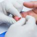 VitalityLife moves to finger-prick testing