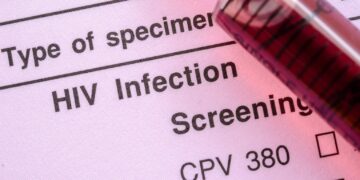 ABI publishes guide to HIV & life insurance