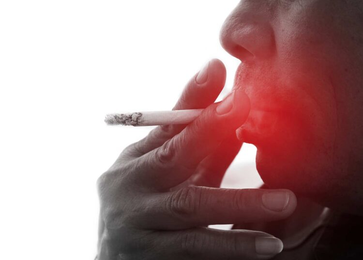 Questioning equity release client health ‘a must’