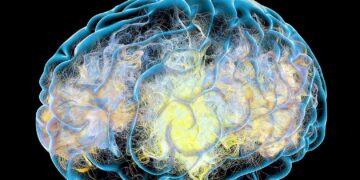 When retirement dreams are shattered by Alzheimer’s