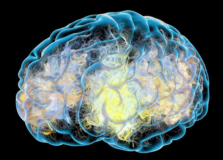 When retirement dreams are shattered by Alzheimer’s