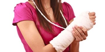 Need for protection policies that cover fractures